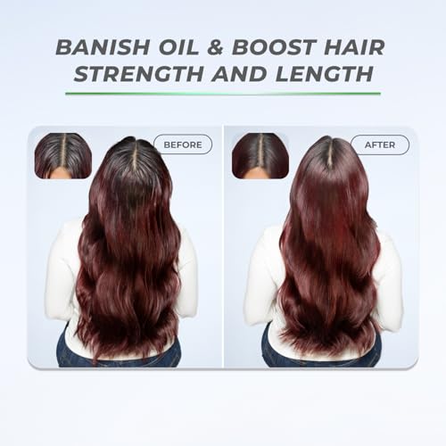 Hair BOOST X Dry Shampoo