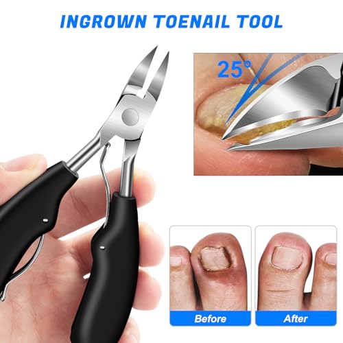 Toenail Clippers for Thick Toenails for Seniors 6PCS (Ingrown & Angled & Slanted)